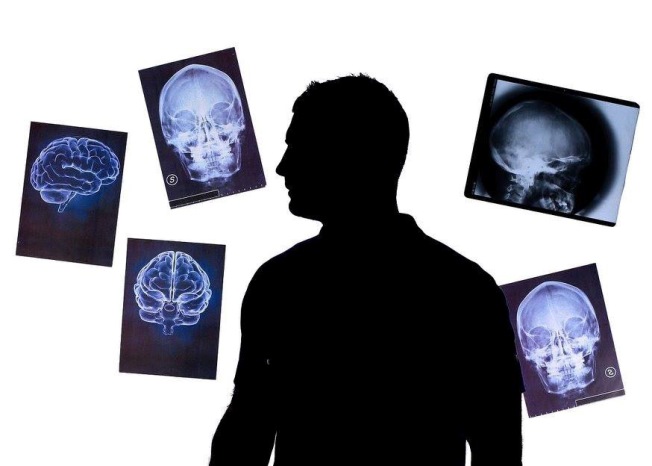 Concussion launch image